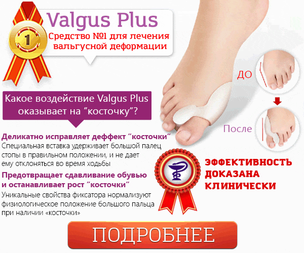 pavlodar varikoz